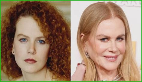 Nicole Kidman's 